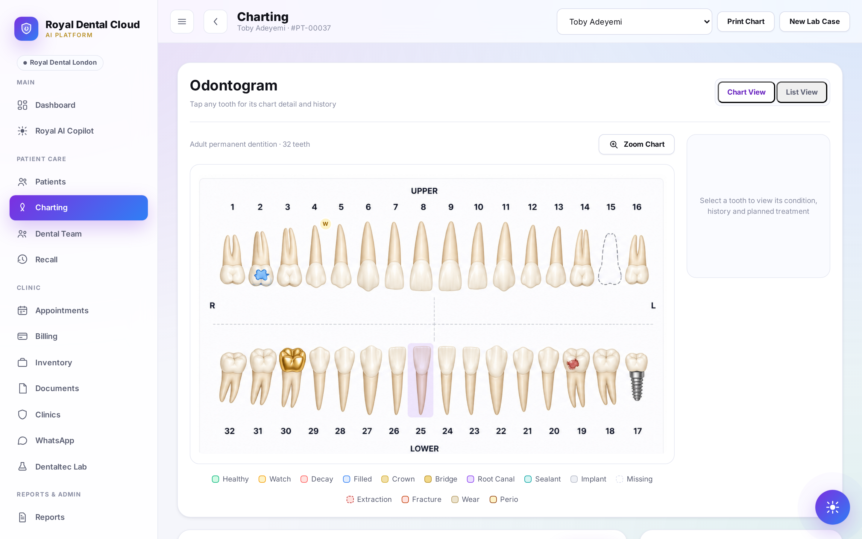 Royal Dental Cloud odontogram charting screen